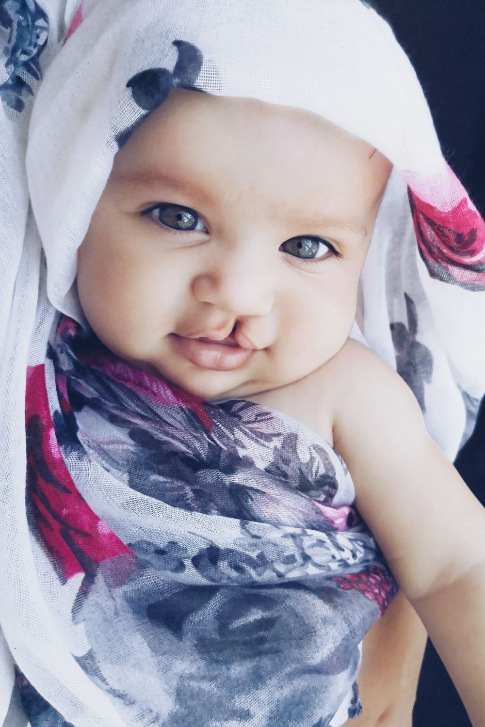 July is National Cleft & Craniofacial Awareness and Prevention Month