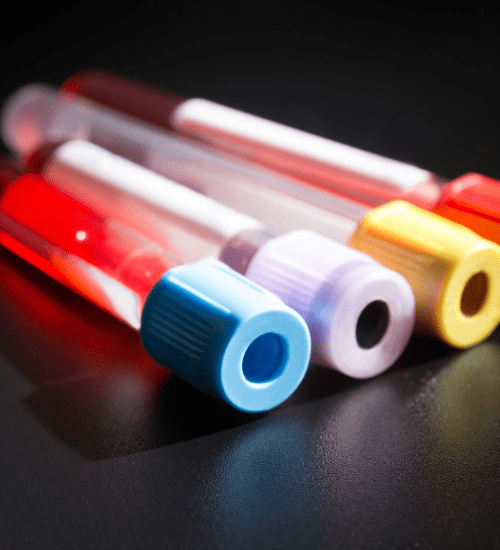 Blood test for hemochromatosis